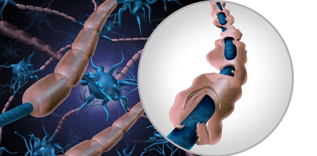 Autoimmune Disease