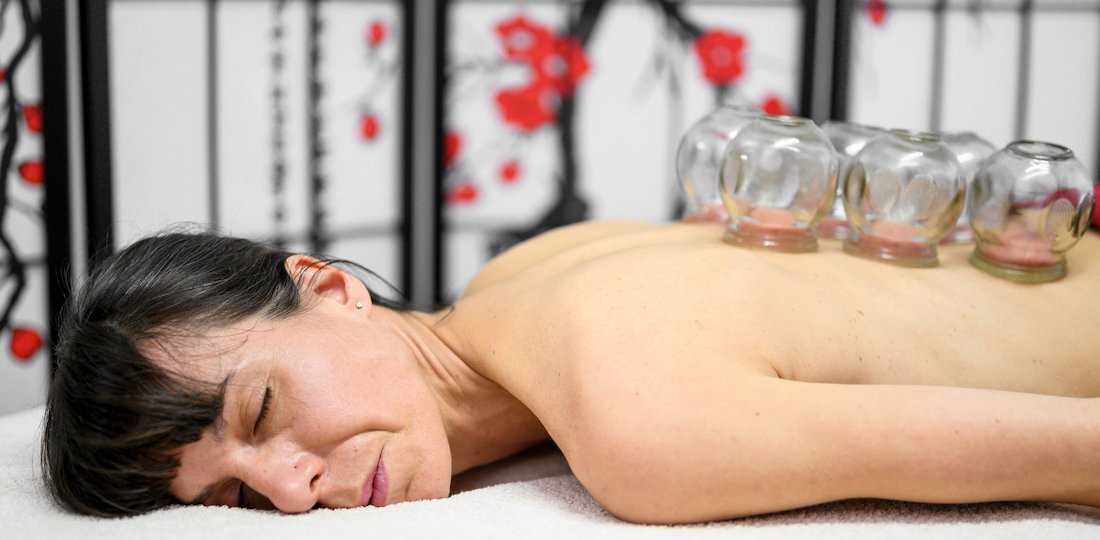 Cupping