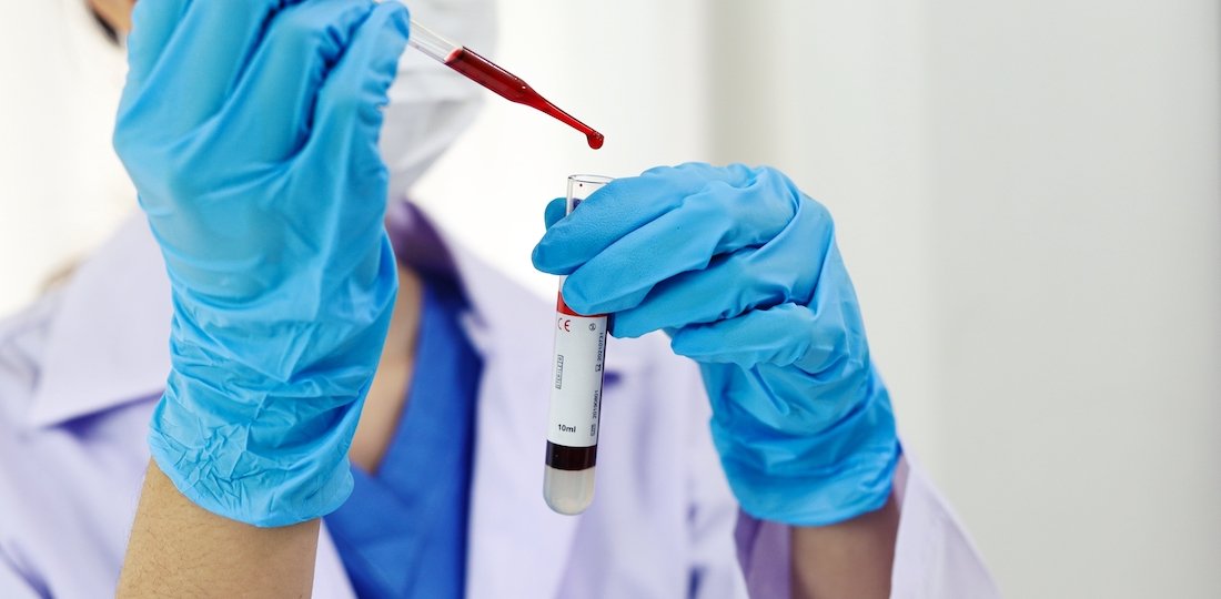 Platelet Therapy