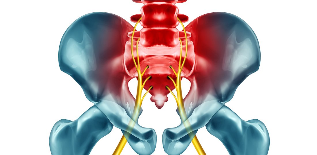 Acupuncture for Sciatica